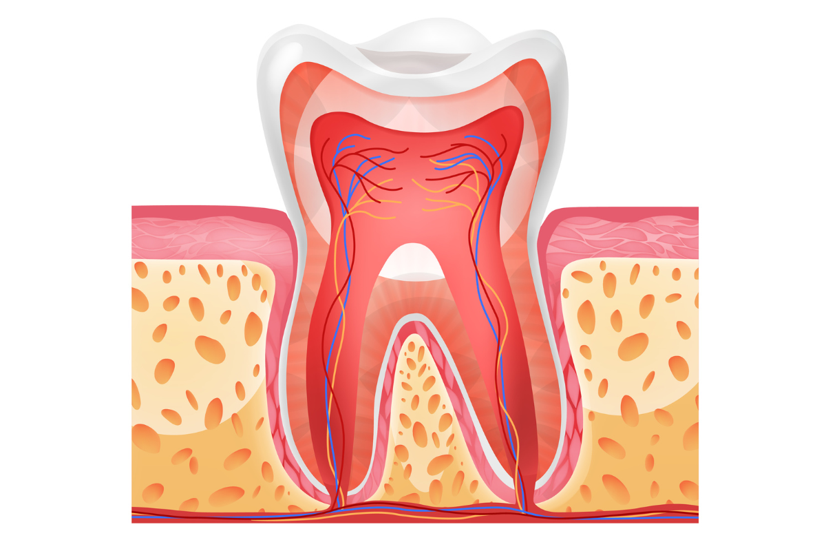 Calculus (Tartar Buildup)